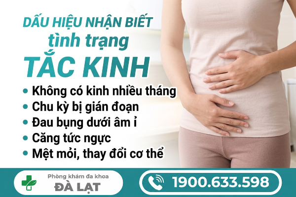 Hình ảnh minh họa